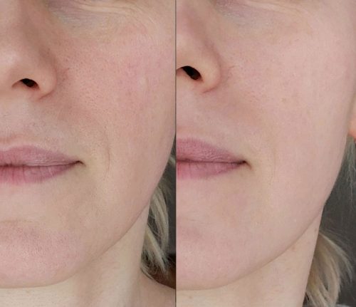 Multi-Peptide Hydrogel Face Mask photo review