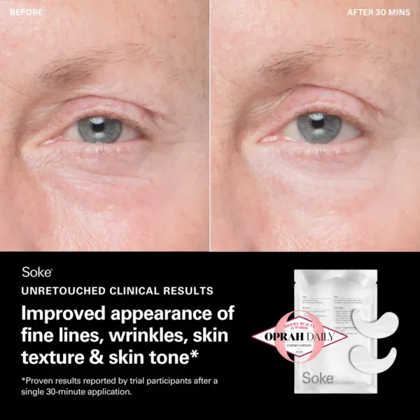 Soke Hydrogel Eye Treatment Patch before and after clinical results — unretouched photography showing improved fine lines, skin texture and skin tone after a single 30-minute application. Oprah Daily Midlife Beauty Award winner 2026.